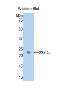 NOS2 / iNOS Antibody - Western blot of recombinant NOS2 / iNOS.  This image was taken for the unconjugated form of this product. Other forms have not been tested.