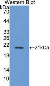 NOS2 / iNOS Antibody - Western Blot; Sample: Recombinant protein.