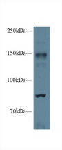 NOS2 / iNOS Antibody - Western Blot; Sample: Mouse Cerebrum lysate; Primary Ab: 1µg/ml Rabbit Anti-Mouse NOS2 Antibody Second Ab: 0.2µg/mL HRP-Linked Caprine Anti-Rabbit IgG Polyclonal Antibody
