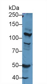 NOS2 / iNOS Antibody - Western Blot; Sample: Rat Cerebrum lysate; Primary Ab: 1µg/ml Rabbit Anti-Rat NOS2 Antibody Second Ab: 0.2µg/mL HRP-Linked Caprine Anti-Rabbit IgG Polyclonal Antibody