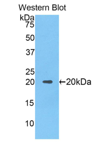 NOS2 / iNOS Antibody - Western blot of recombinant NOS2 / iNOS.  This image was taken for the unconjugated form of this product. Other forms have not been tested.