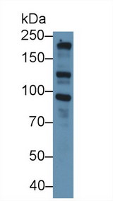 NOS2 / iNOS Antibody - Western Blot; Sample: Mouse Cerebrum lysate; Primary Ab: 2µg/ml Rabbit Anti-Mouse NOS2 Antibody Second Ab: 0.2µg/mL HRP-Linked Caprine Anti-Rabbit IgG Polyclonal Antibody (Catalog: SAA544Rb19