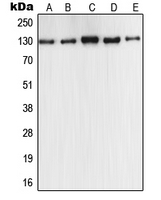 NOS2 / iNOS Antibody - Western blot analysis of iNOS expression in MCF7 (A); A549 (B); Raw264.7 (C); PC12 (D); rat liver (E) whole cell lysates.
