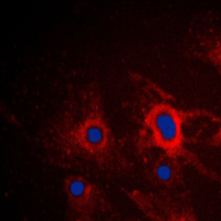 NOS2 / iNOS Antibody - Immunofluorescent analysis of iNOS staining in A549 cells. Formalin-fixed cells were permeabilized with 0.1% Triton X-100 in TBS for 5-10 minutes and blocked with 3% BSA-PBS for 30 minutes at room temperature. Cells were probed with the primary antibody in 3% BSA-PBS and incubated overnight at 4 C in a humidified chamber. Cells were washed with PBST and incubated with a DyLight 594-conjugated secondary antibody (red) in PBS at room temperature in the dark. DAPI was used to stain the cell nuclei (blue).