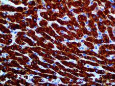 NOS2 / iNOS Antibody - IHC of iNOS on an FFPE Liver Tissue