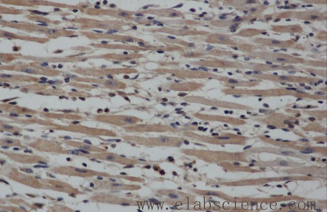 NOS2 / iNOS Antibody - Immunohistochemistry of paraffin-embedded mouse heart using NOS2 Polyclonal Antibody at dilution of 1:50.
