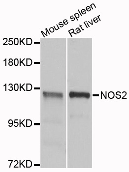 NOS2 / iNOS Antibody - Western blot analysis of extracts of various cells.