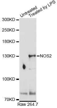 NOS2 / iNOS Antibody - Western blot analysis of extracts of Raw 264.7 cells, using NOS2 antibodyat 1:1000 dilution. Raw264.7 cells were treated by LPS (1 µg/ml) for 8 hours. The secondary antibody used was an HRP Goat Anti-Rabbit IgG (H+L) at 1:10000 dilution. Lysates were loaded 25ug per lane and 3% nonfat dry milk in TBST was used for blocking. An ECL Kit was used for detection and the exposure time was 90s.