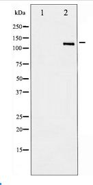 NOS2 / iNOS Antibody - Western blot of iNOS expression in NIH-3T3 whole cell lysates,The lane on the left is treated with the antigen-specific peptide.