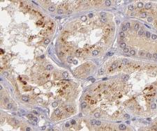 NOS2 / iNOS Antibody - 1:200 staining human kidney tissue by IHC-P. The tissue was formaldehyde fixed and a heat mediated antigen retrieval step in citrate buffer was performed. The tissue was then blocked and incubated with the antibody for 1.5 hours at 22°C. An HRP conjugated goat anti-rabbit antibody was used as the secondary.