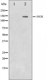 NOS2 / iNOS Antibody - Western blot analysis on NIH-3T3 cell lysates using iNOS antibody. The lane on the left is treated with the antigen-specific peptide.