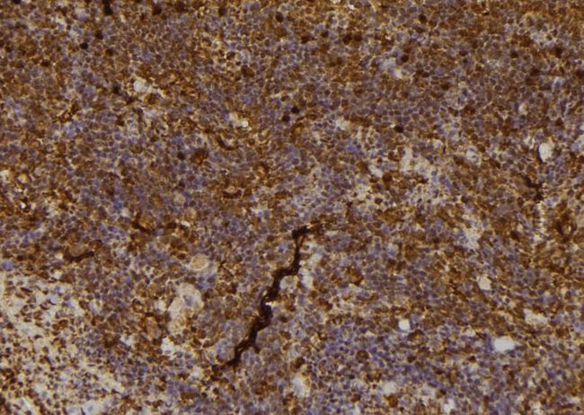 NOS2 / iNOS Antibody - 1:100 staining mouse spleen tissue by IHC-P. The sample was formaldehyde fixed and a heat mediated antigen retrieval step in citrate buffer was performed. The sample was then blocked and incubated with the antibody for 1.5 hours at 22°C. An HRP conjugated goat anti-rabbit antibody was used as the secondary.