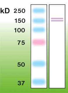 NOS2 / iNOS Antibody - Western blot of i(n)NOS in mouse brain crude lysate (50 ug of protein loaded).