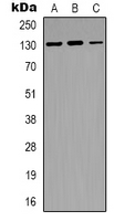 NOS2 / iNOS Antibody - Western blot analysis of iNOS expression in Jurkat (A); SHSY5Y (B); NIH3T3 (C) whole cell lysates.