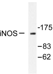 NOS2 / iNOS Antibody - Western blot of iNOS (V1131) pAb in extracts from HeLa cells.