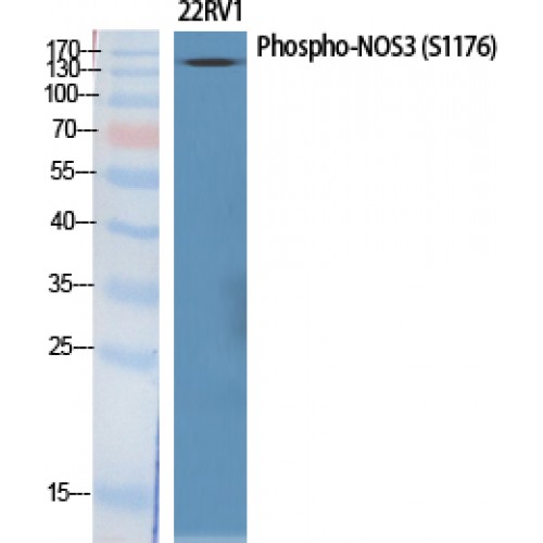 NOS3 / eNOS Antibody - Western blot of Phospho-NOS3 (S1177) antibody