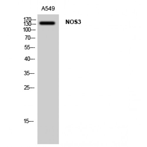 NOS3 / eNOS Antibody - Western blot of NOS3 antibody