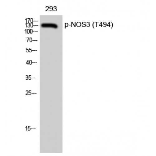 NOS3 / eNOS Antibody - Western blot of Phospho-NOS3 (T494) antibody