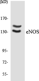 NOS3 / eNOS Antibody - Western blot analysis of the lysates from HepG2 cells using eNOS antibody.