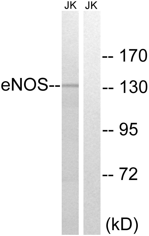 NOS3 / eNOS Antibody - Western blot analysis of lysates from Jurkat cells, treated with Insulin 0.01U/ml 15', using eNOS Antibody. The lane on the right is blocked with the synthesized peptide.