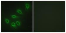NOS3 / eNOS Antibody - Immunofluorescence analysis of HeLa cells, using eNOS Antibody. The picture on the right is blocked with the synthesized peptide.