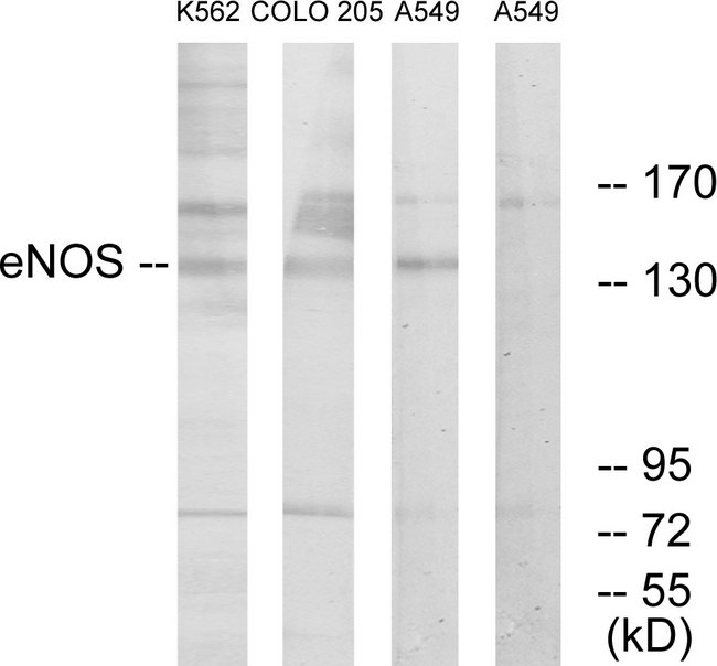NOS3 / eNOS Antibody - Western blot analysis of lysates from A549, K562, and COLO205 cells, using eNOS Antibody. The lane on the right is blocked with the synthesized peptide.
