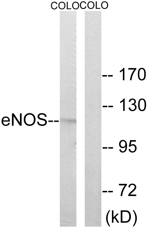 NOS3 / eNOS Antibody - Western blot analysis of lysates from COLO cells, using eNOS Antibody. The lane on the right is blocked with the synthesized peptide.