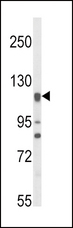 NOS3 / eNOS Antibody - Western blot of NOS3 Antibody in HL-60 cell line lysates (35 ug/lane). NOS3 (arrow) was detected using the purified antibody.