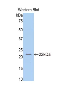 NOS3 / eNOS Antibody - Western blot of recombinant NOS3 / eNOS.  This image was taken for the unconjugated form of this product. Other forms have not been tested.