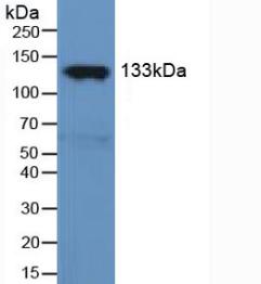 NOS3 / eNOS Antibody - Western Blot; Sample: Rat Serum.