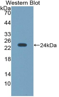 NOS3 / eNOS Antibody - Western blot of recombinant NOS3 / eNOS.