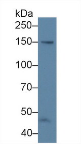 NOS3 / eNOS Antibody - Western Blot; Sample: Human 304 cell lysate; Primary Ab: 5µg/ml Rabbit Anti-Bovine NOS3 Antibody Second Ab: 0.2µg/mL HRP-Linked Caprine Anti-Rabbit IgG Polyclonal Antibody