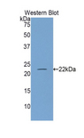 NOS3 / eNOS Antibody - Western blot of recombinant NOS3 / eNOS encoding amino acids 522-705.  This image was taken for the unconjugated form of this product. Other forms have not been tested.
