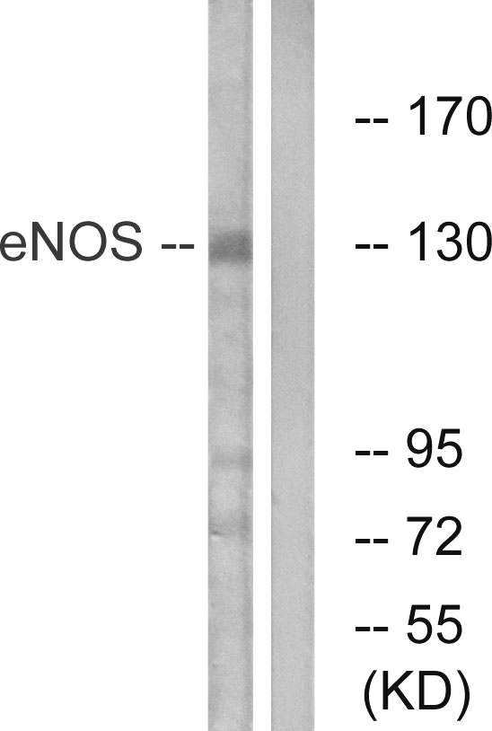 NOS3 / eNOS Antibody - Western blot analysis of lysates from Jurkat cells, using eNOS Antibody. The lane on the right is blocked with the synthesized peptide.
