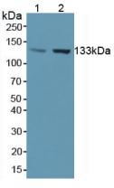 NOS3 / eNOS Antibody - Western Blot; Sample: Lane1: Human Liver Tissue; Lane2: Human Placenta Tissue.