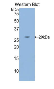 NOS3 / eNOS Antibody - Western blot of recombinant NOS3 / eNOS.  This image was taken for the unconjugated form of this product. Other forms have not been tested.