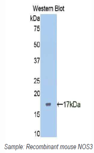 NOS3 / eNOS Antibody - Western blot of recombinant NOS3 / eNOS.  This image was taken for the unconjugated form of this product. Other forms have not been tested.