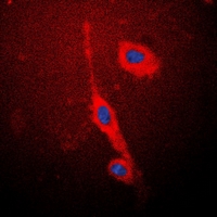NOS3 / eNOS Antibody - Immunofluorescent analysis of eNOS staining in MCF7 cells. Formalin-fixed cells were permeabilized with 0.1% Triton X-100 in TBS for 5-10 minutes and blocked with 3% BSA-PBS for 30 minutes at room temperature. Cells were probed with the primary antibody in 3% BSA-PBS and incubated overnight at 4 deg C in a humidified chamber. Cells were washed with PBST and incubated with a DyLight 594-conjugated secondary antibody (red) in PBS at room temperature in the dark. DAPI was used to stain the cell nuclei (blue).