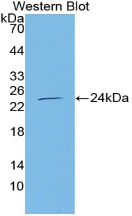 NOS3 / eNOS Antibody - Western Blot; Sample: Recombinant protein.