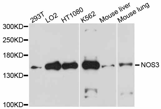 NOS3 / eNOS Antibody - Western blot analysis of extracts of various cell lines, using NOS3 antibody at 1:1000 dilution. The secondary antibody used was an HRP Goat Anti-Rabbit IgG (H+L) at 1:10000 dilution. Lysates were loaded 25ug per lane and 3% nonfat dry milk in TBST was used for blocking. An ECL Kit was used for detection and the exposure time was 30s.