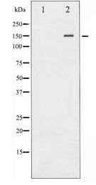 NOS3 / eNOS Antibody - Western blot of eNOS expression in Insulin treated HeLa whole cell lysates,The lane on the left is treated with the antigen-specific peptide.