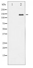 NOS3 / eNOS Antibody - Western blot of eNOS expression in COLO205 whole cell lysates,The lane on the left is treated with the antigen-specific peptide.