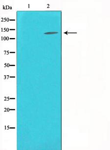 NOS3 / eNOS Antibody - Western blot analysis on K562 cell lysates using eNOS antibody. The lane on the left is treated with the antigen-specific peptide.