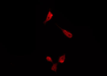 NOS3 / eNOS Antibody - Staining K562 cells by IF/ICC. The samples were fixed with PFA and permeabilized in 0.1% Triton X-100, then blocked in 10% serum for 45 min at 25°C. The primary antibody was diluted at 1:200 and incubated with the sample for 1 hour at 37°C. An Alexa Fluor 594 conjugated goat anti-rabbit IgG (H+L) Ab, diluted at 1/600, was used as the secondary antibody.