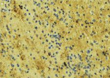 NOS3 / eNOS Antibody - 1:100 staining mouse liver tissue by IHC-P. The sample was formaldehyde fixed and a heat mediated antigen retrieval step in citrate buffer was performed. The sample was then blocked and incubated with the antibody for 1.5 hours at 22°C. An HRP conjugated goat anti-rabbit antibody was used as the secondary.