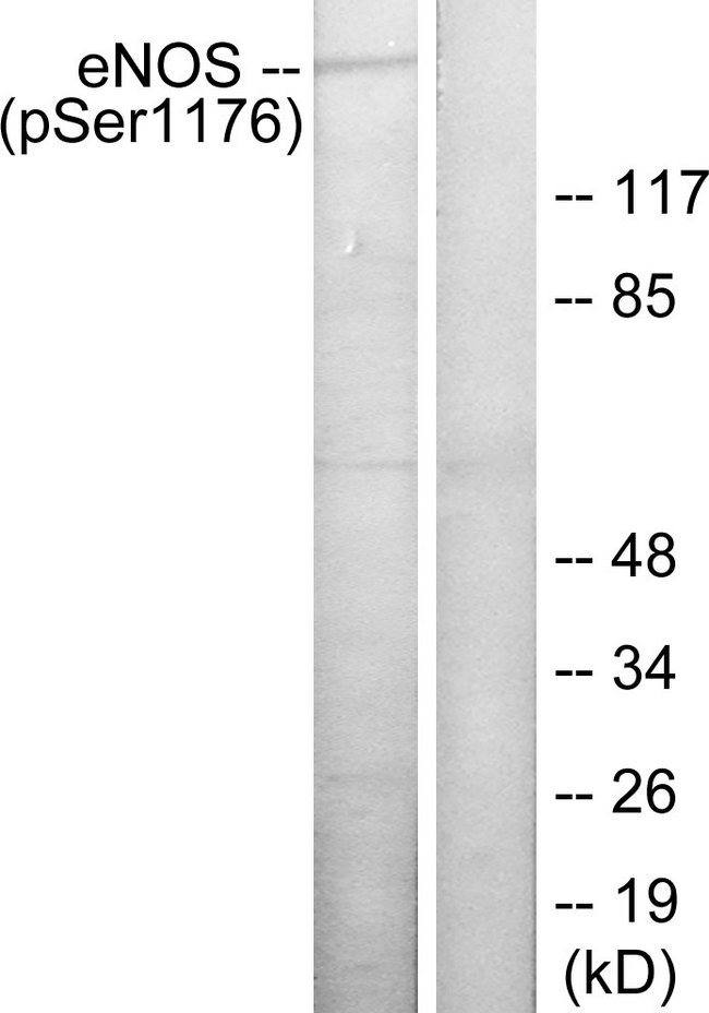 NOS3 / eNOS Antibody - Western blot analysis of lysates from HeLa cells treated with Insulin 0.01U/ml 15', using eNOS (Phospho-Ser1176) Antibody. The lane on the right is blocked with the phospho peptide.