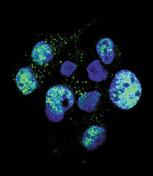 NOS3 / eNOS Antibody - Confocal immunofluorescence of Phospho-eNos-S1177 Antibody with HepG2 cell followed by Alexa Fluor 488-conjugated goat anti-rabbit lgG (green). DAPI was used to stain the cell nuclear (blue).