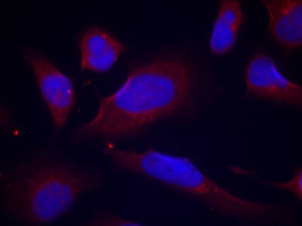 NOS3 / eNOS Antibody - Immunofluorescence staining of methanol-fixed HeLa cells.