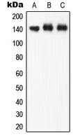 NOS3 / eNOS Antibody - Western blot analysis of eNOS (pS1177) expression in A549 (A); HUVEC (B); rat brain (C) whole cell lysates.
