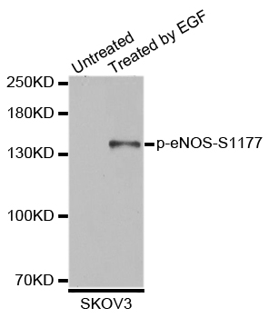 NOS3 / eNOS Antibody - Western blot analysis of extracts of SKOV3 cells.
